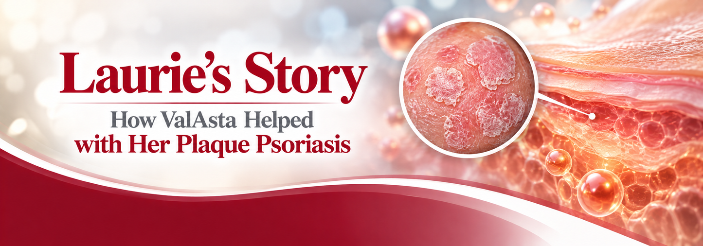 Plaque Psoriasis - November 8, 2022
