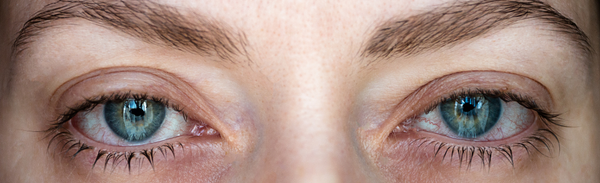Ask Sam - Eye Diseases