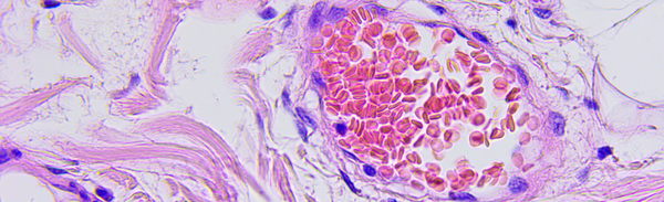 Astaxanthin / ValAsta suppresses the metastasis of colon cancer